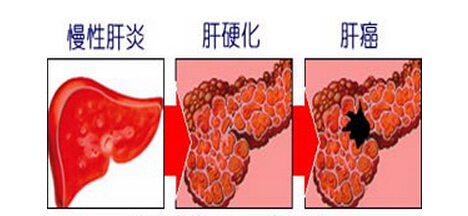 �����򡿸�Ӳ���γɵ�ԭ������Щ