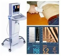 ����˲ʱ���Լ��:�жϸ���ά���͸�Ӳ�ȱز����ٵļ��