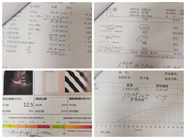 郑州看乙肝哪个医院比较好?河南十大乙肝医院排名